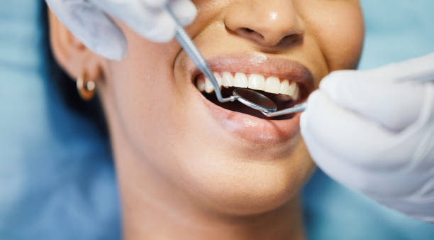 Best Emergency Root Canal Therapy in Lake Winnebago, MO